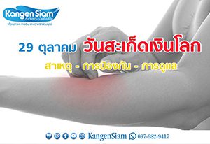 สะเก็ดเงิน01